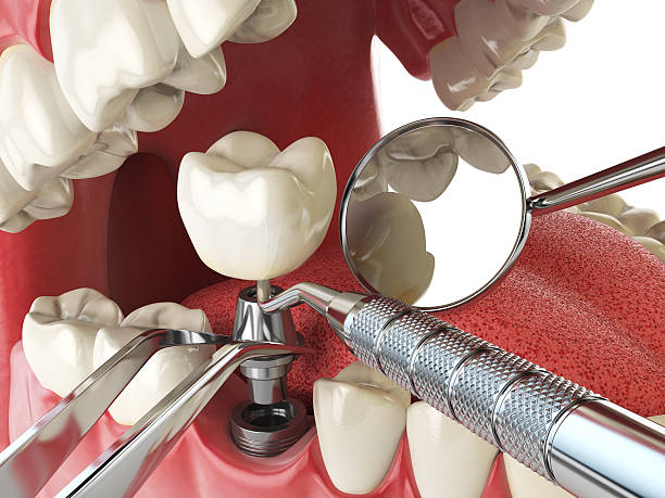 Best Emergency Dental Services for Seniors in Ellport, PA